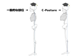 一般的な肢位との比較