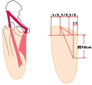 比較 大腿義足ソケット ページ 3 そうだいのpo学生応援ブログ