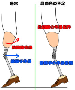 大腿義足の屈曲角の不足における現象