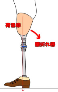 大腿義足において足部が背屈位の場合での膝折れ感（前方への不安定）