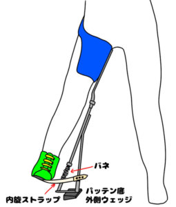 トライラテラル型（= Tachdjian型）