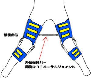 バチェラー型