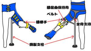 西尾式外転股装具