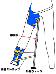 （改良型）ポーゴスティック型 = NPS装具（New Pogo - Stick 装具）