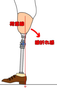 大腿義足において（膝伸展位で）つま先が浮き上がっている場合での膝折れ感（前方への不安定）
