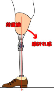 大腿義足において足部が床面に平らに接地している場合での膝折れ感（前方への不安定）