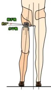 片側骨盤切除用股義足_ベンチアライメント